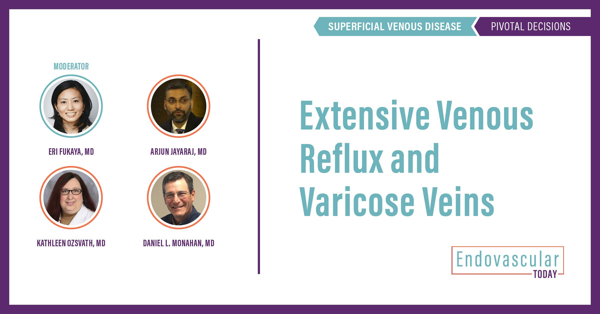 Extensive Venous Reflux and Varicose Veins Endovascular Today